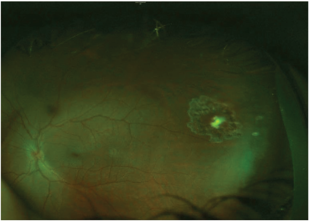 Figure 2