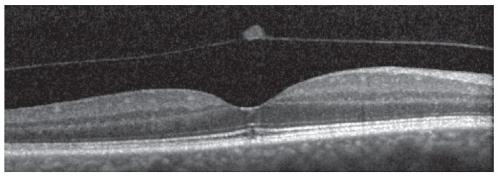 Figure 11