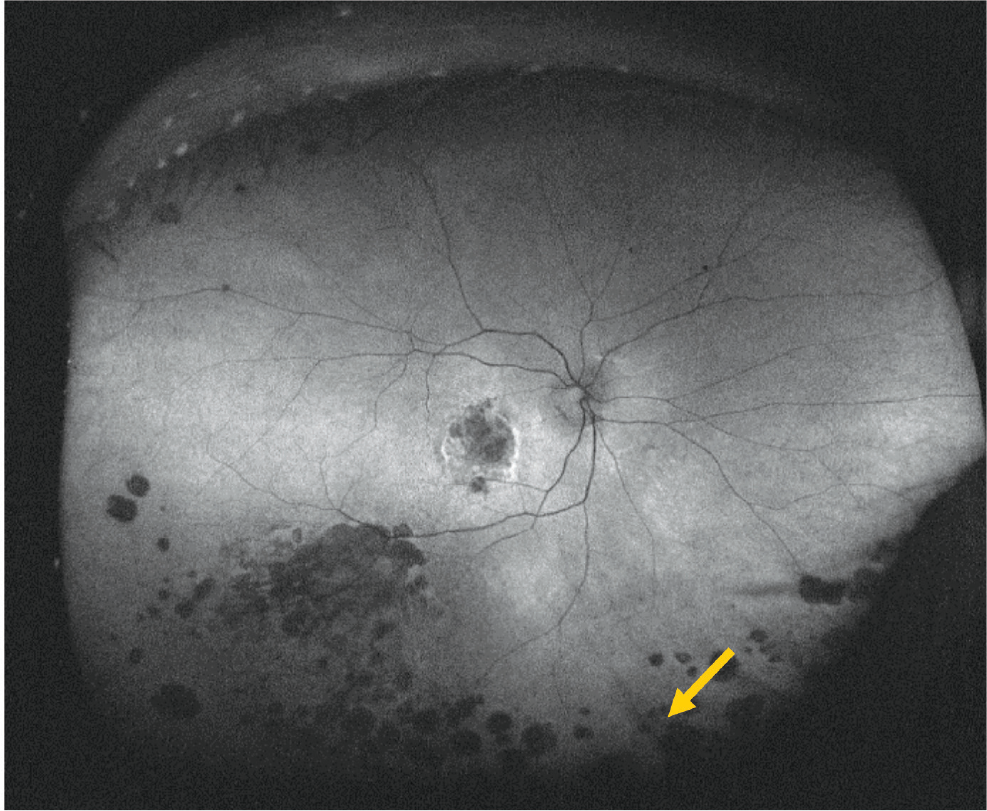Figure 12