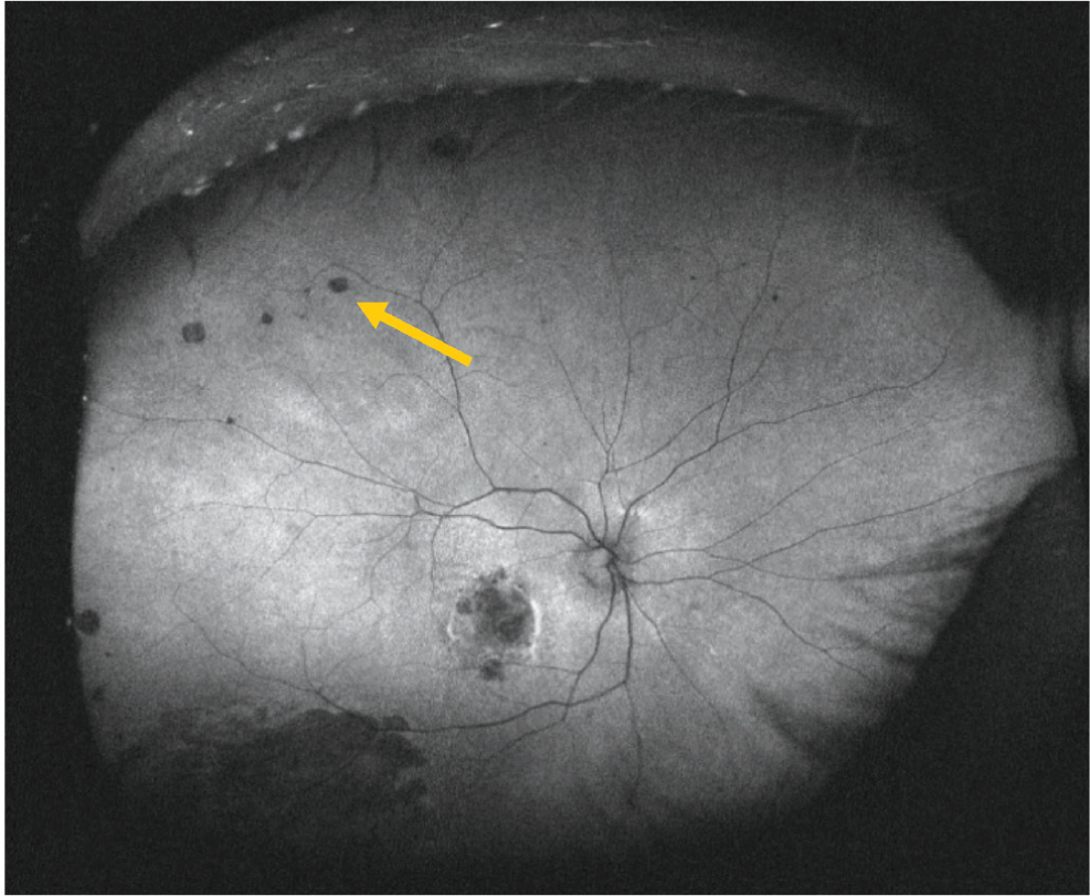 Figure 11