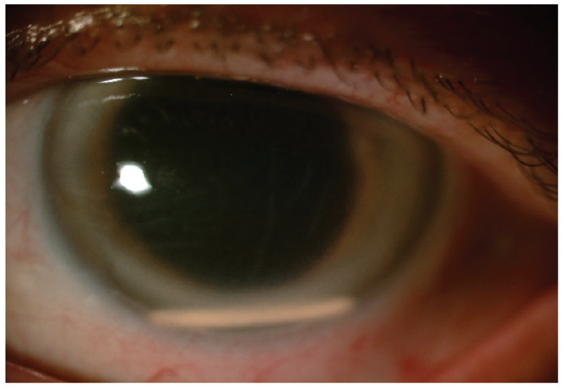 Figure 11