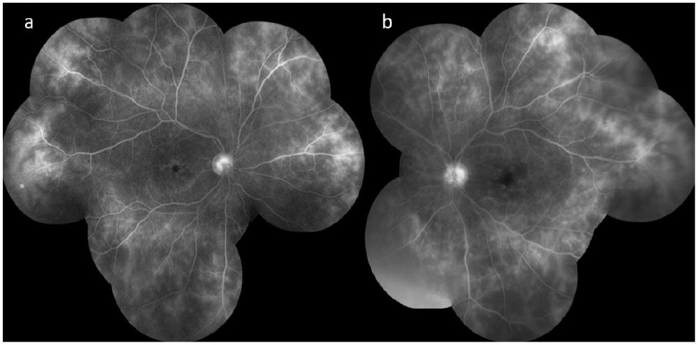 Figure 14