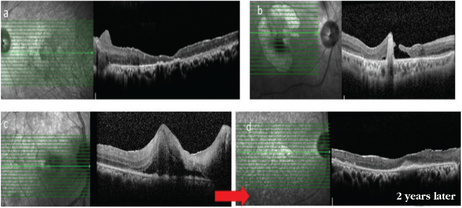 Figure 16