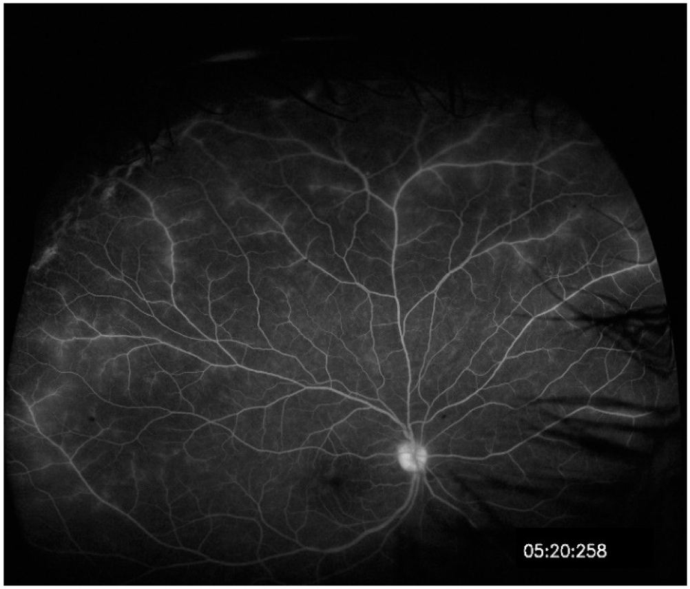 Figure 15