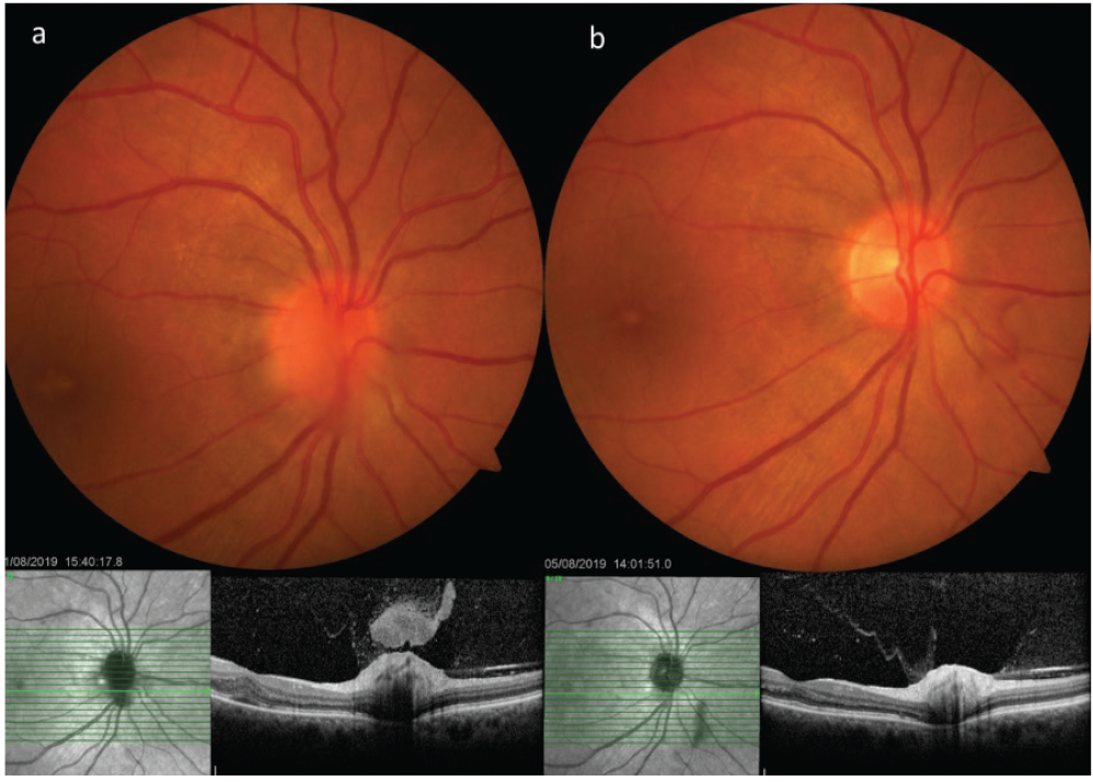 Figure 18