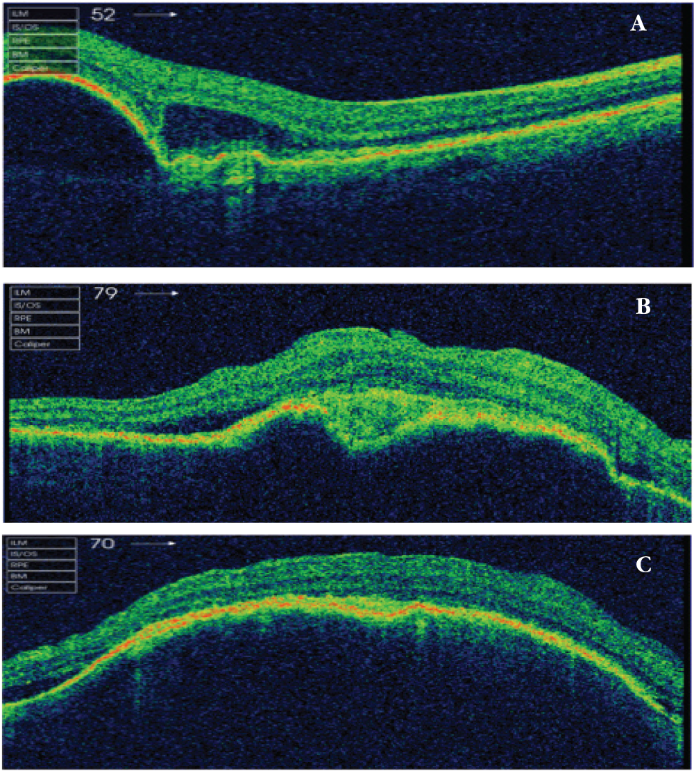 Figure 4