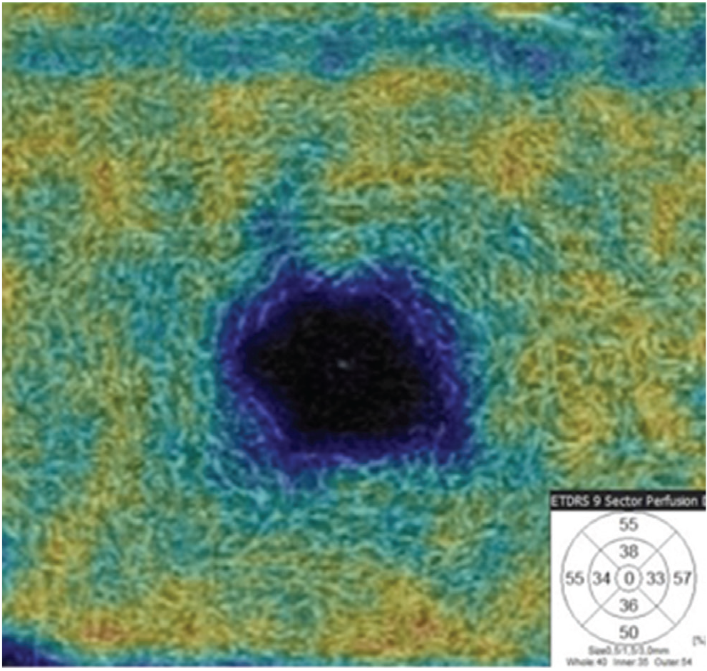 Figure 2b