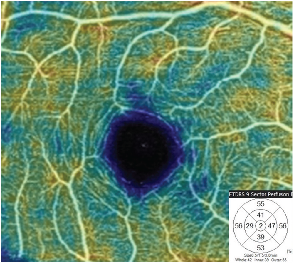 Figure 2a