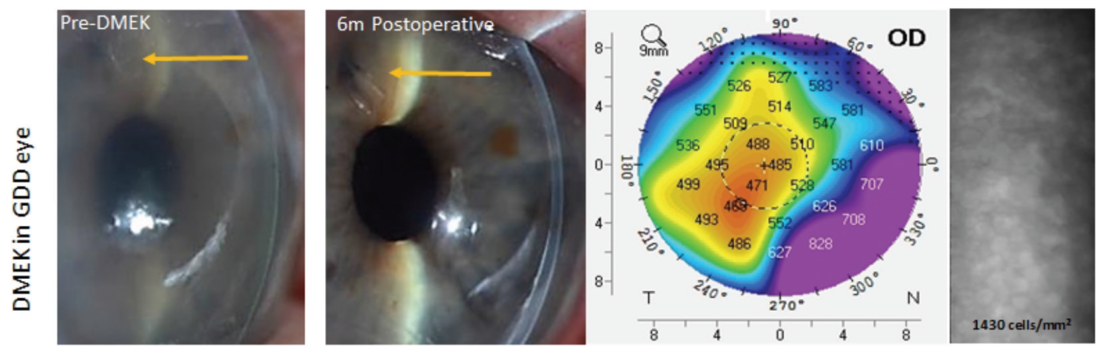 Figure 3b