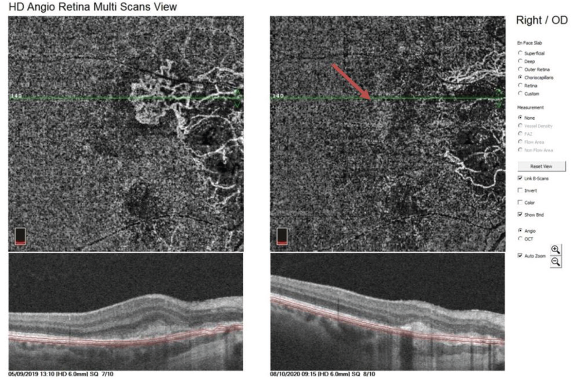 Figure 12