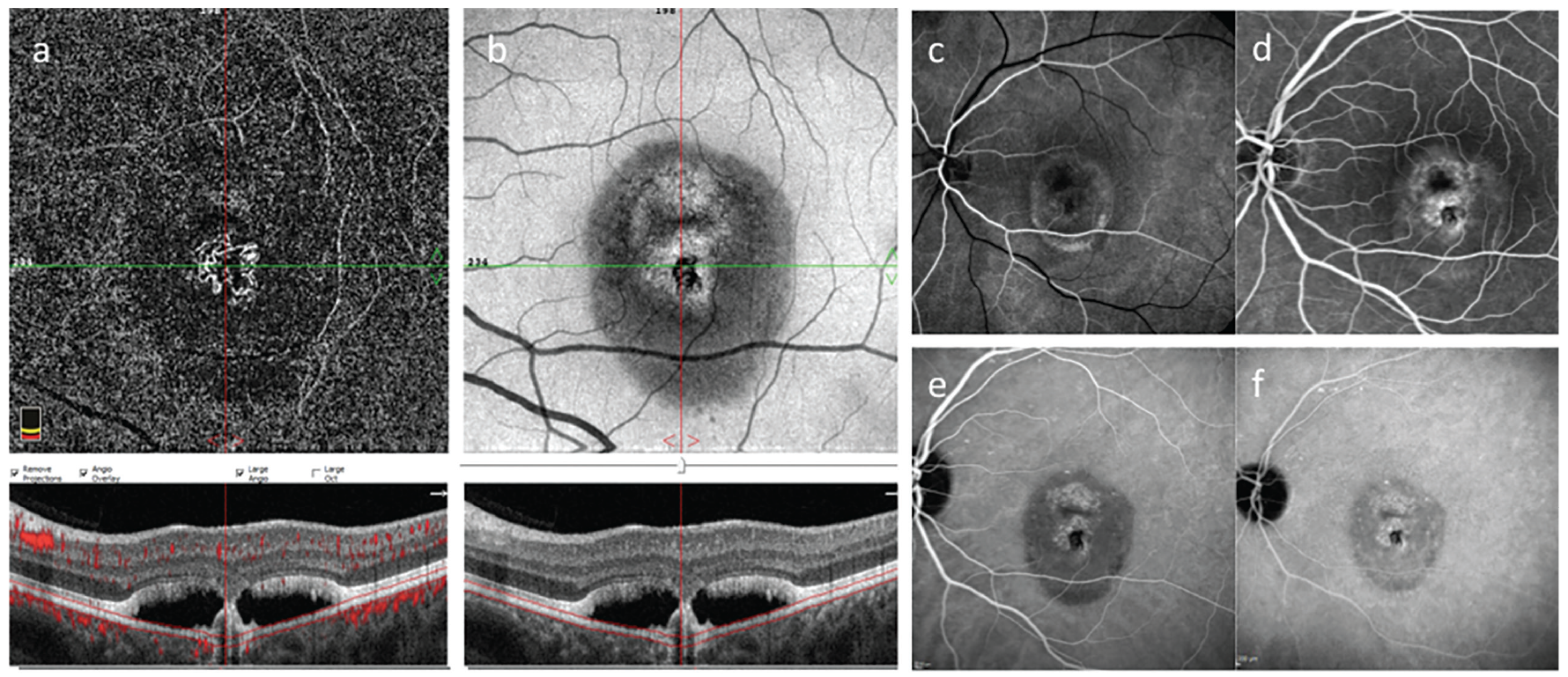 Figure 4