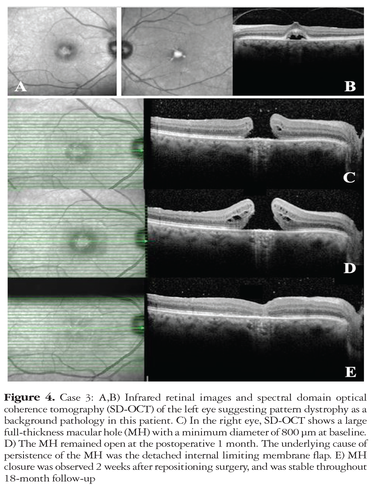 Figure 4