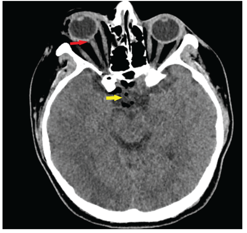 Figure 2
