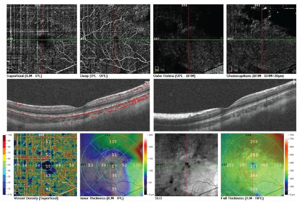 Figure 4
