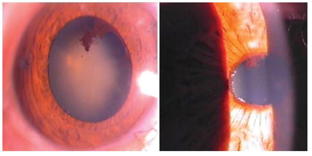Figure 11