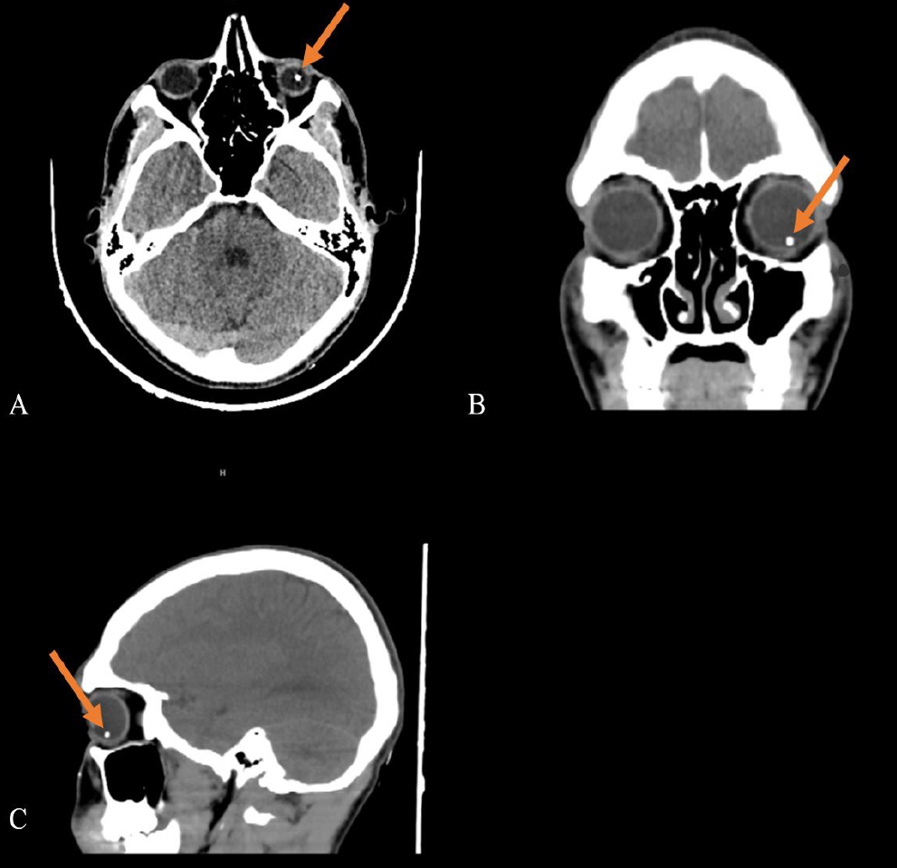 Figure 4
