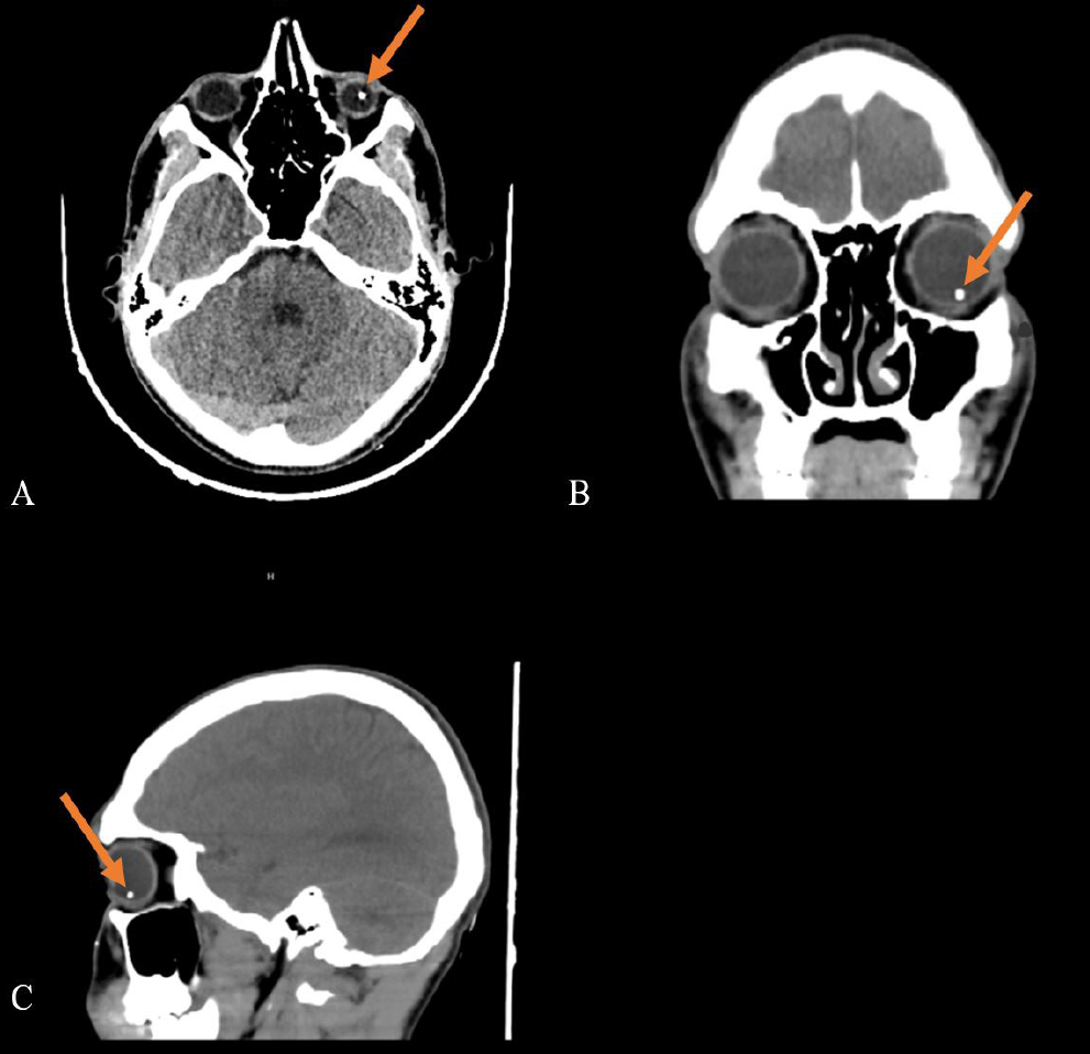 Figure 4
